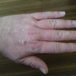 Hand 6/5 2014 (131 dygn)